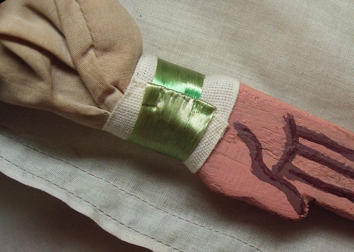 Polso destro dopo il restauro